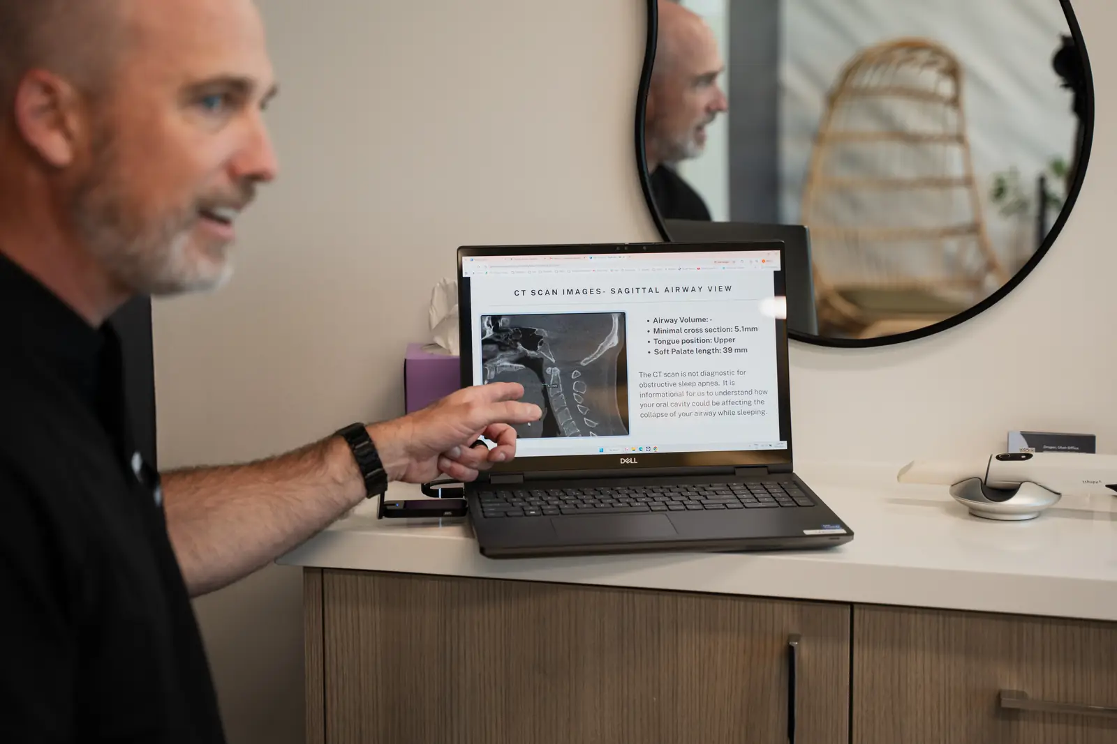 Dr. Jeff Buxton reviewing a 3D CT airway scan on a laptop during a consultation in Draper, Utah