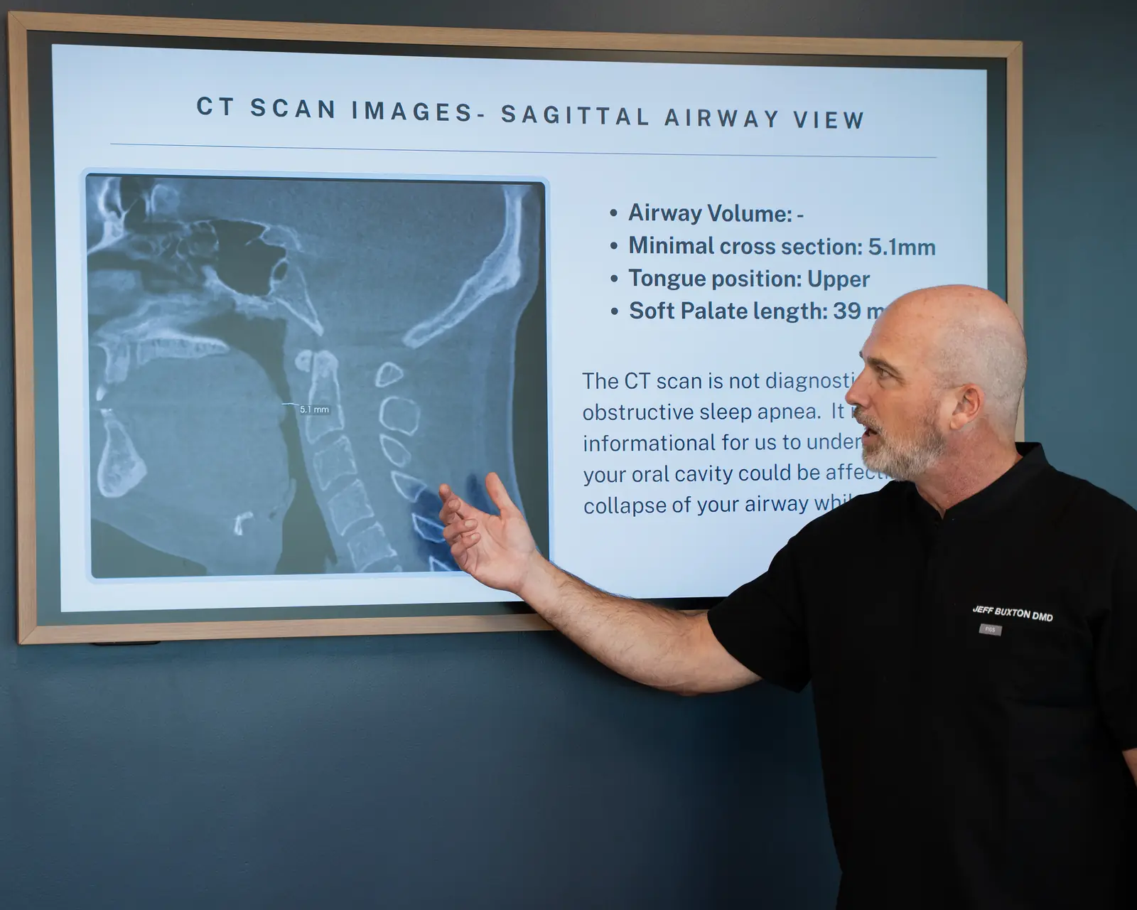 Dr. Jeff Buxton pointing to a sagittal airway view on a CBCT scan at Toothpillow Breathing and Sleep Center in Draper, Utah